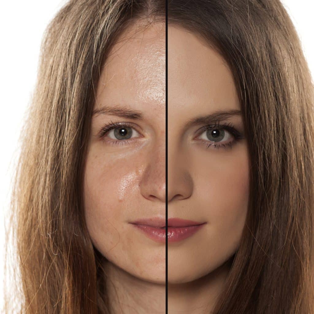 You are currently viewing How to Build a Skincare Routine for Your Skin Type